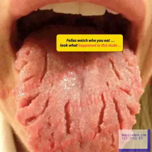 Photo: His Tongue Starts Falling Apart Gradually After Eating Down Of Her